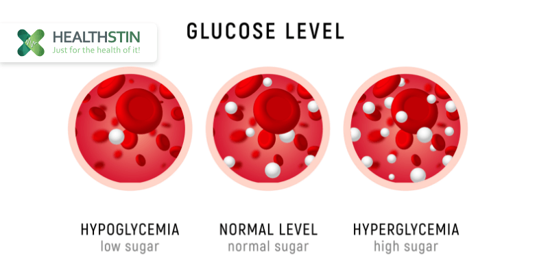 Exercise and Diabetes: Q&A With Dr Rachelle Sultana 5 3 types of glucose level